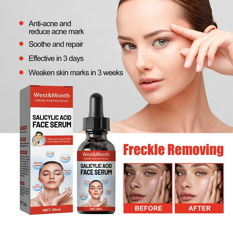 Nicotinamide Attenuates Stains  Facial Essence Salicylic Acid Shrinks Pores Freckle Removal Moisturizes Skin Care Products 2024