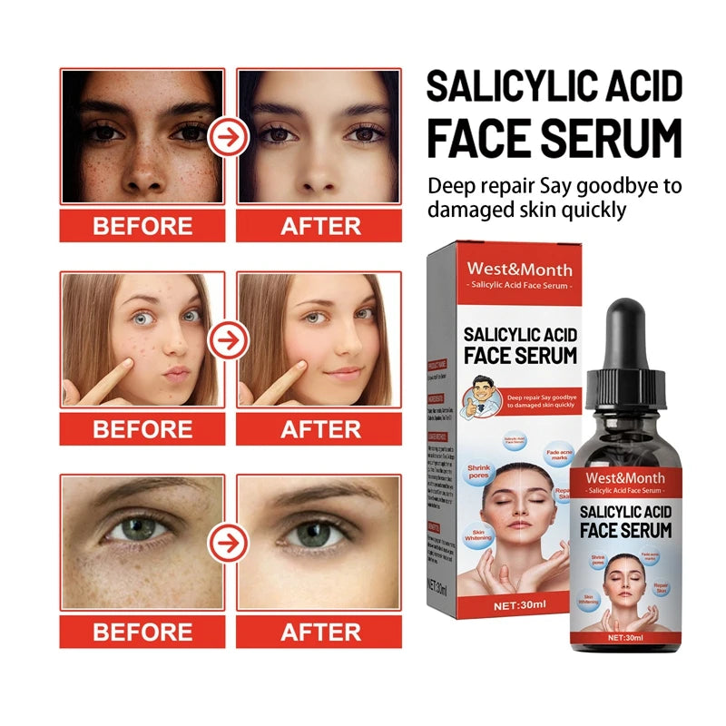 Nicotinamide Attenuates Stains  Facial Essence Salicylic Acid Shrinks Pores Freckle Removal Moisturizes Skin Care Products 2024